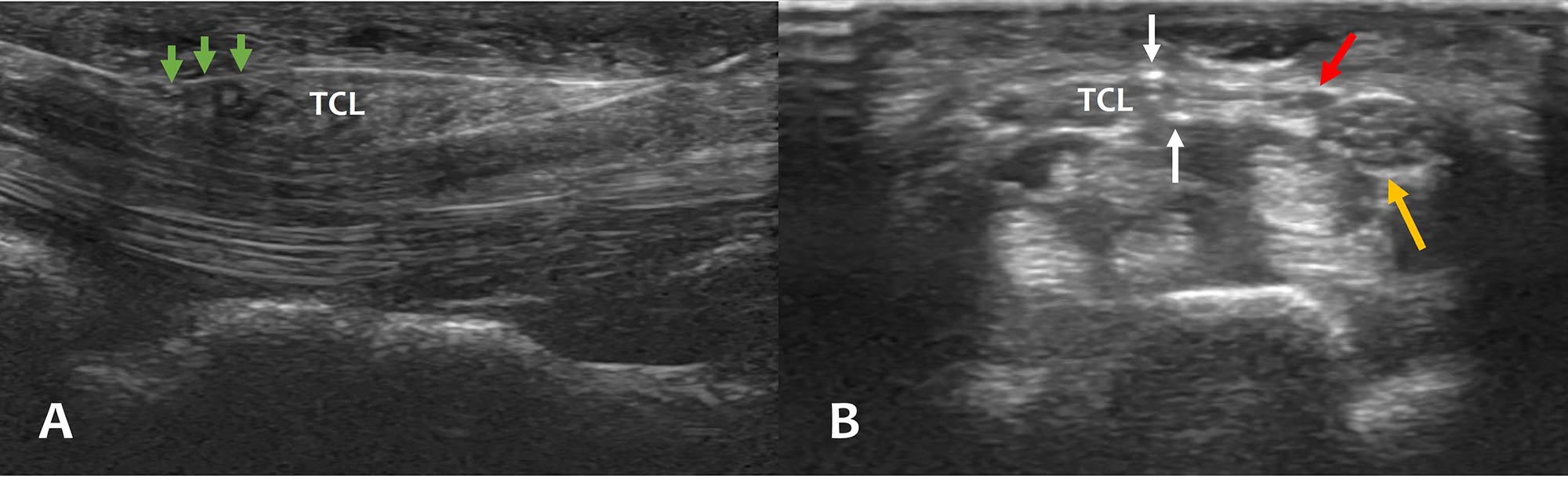 ultrasound ultrasound